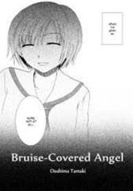 Bruise-Covered Angel